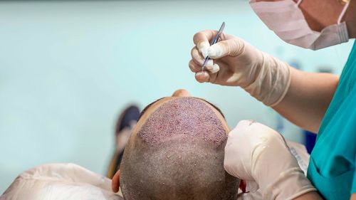 Top Hair Restoration Clinics in the USA